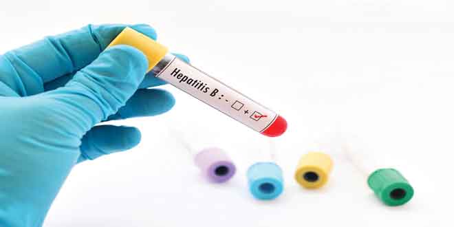 گایدلاین جدید بالینی در زمینه ویروس هپاتیت B