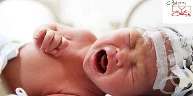 عکس از گزارش بالینی،نوزاد ۸روزه با سن بارداری ۳۷هفته