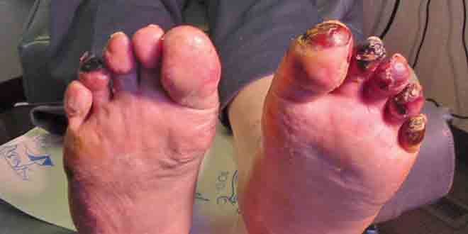 عکس از گزارش بالینی/ مردی ۳۷ ساله با درد پا