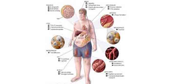 عکس از بیماریهای متابولیک ارثی و تشخیص بہ موقع