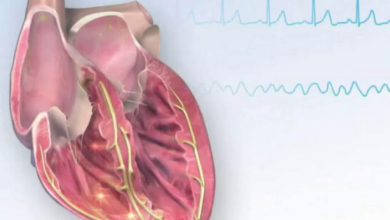 Photo of پایش مداوم فیبریلاسیون دهلیزی پس از جراحی بایپس: آیا ضدانعقاد طولانیمدت ضروری است؟