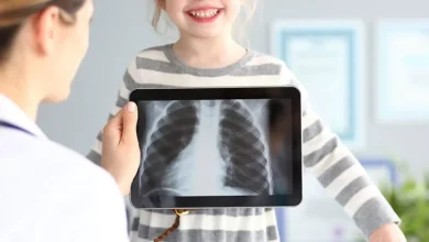 Photo of تفاوت در استفاده از رادیوگرافی قفسه سینه در کودکان مبتلا به ذات‌الریه