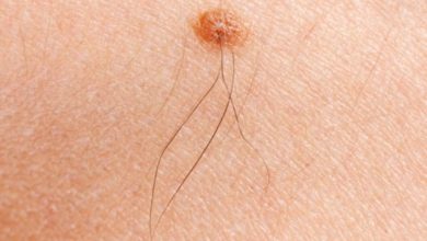 Photo of توریپالیماب در مقایسه با داکاربازین؛ درمان خط اول مؤثرتر برای ملانوم پیشرفته از نوع آکرال