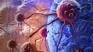 Photo of درمان کانونی نجات‌بخش در برابر پروستاتکتومی رادیکال نجات‌بخش در سرطان پروستات عودکننده موضعی پس از رادیوتراپی