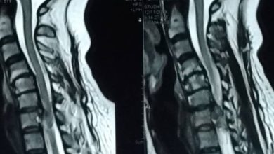 Photo of رادیومیکس در گوش و حلق و بینی و جراحی سر و گردن: ابزار نوین پزشکی دقیق