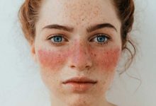 Photo of کاهش فعالیت بیماری لوپوس با آنیفرولوماب؛ SIGLEC-1 به‌عنوان نشانگر زیستی نویدبخش برای پایش پاسخ درمانی