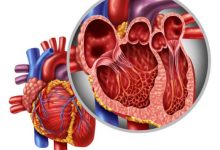 Photo of اختلال عملکرد میوکارد در نارسایی اولیه دریچه میترال: مقاله مروری از JAMA Cardiology