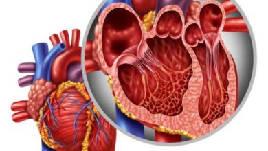 Photo of اختلال عملکرد میوکارد در نارسایی اولیه دریچه میترال: مقاله مروری از JAMA Cardiology