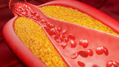Photo of ویرایش پایه‌ی ژن PCSK9 با VERVE-102؛ گامی نوین در درمان پایدار هایپرکلسترولمی