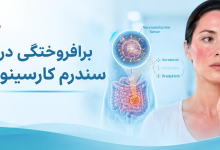 Photo of برافروختگی در سندرم کارسینوئید؛ از پاتوفیزیولوژی تا مدیریت بالینی فلاشینگ مقاوم