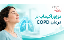 Photo of  توزوراکیماب برای پیشگیری از تشدید بیماری انسدادی مزمن ریه (COPD)